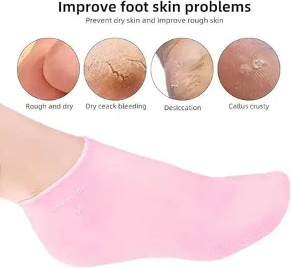 Moisturizing Silicone Spa Gel Socks for Women Men for Dry Feet Cracked Heel Callus Remover Vitamin E Repair (Pink) - My Fashion Sell